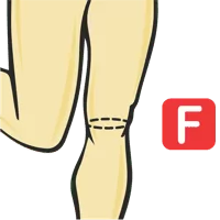 Knee Circumference