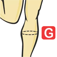 Calf Circumference